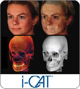 iCAT 3D Imaging at Get It Straight in Rochester NY